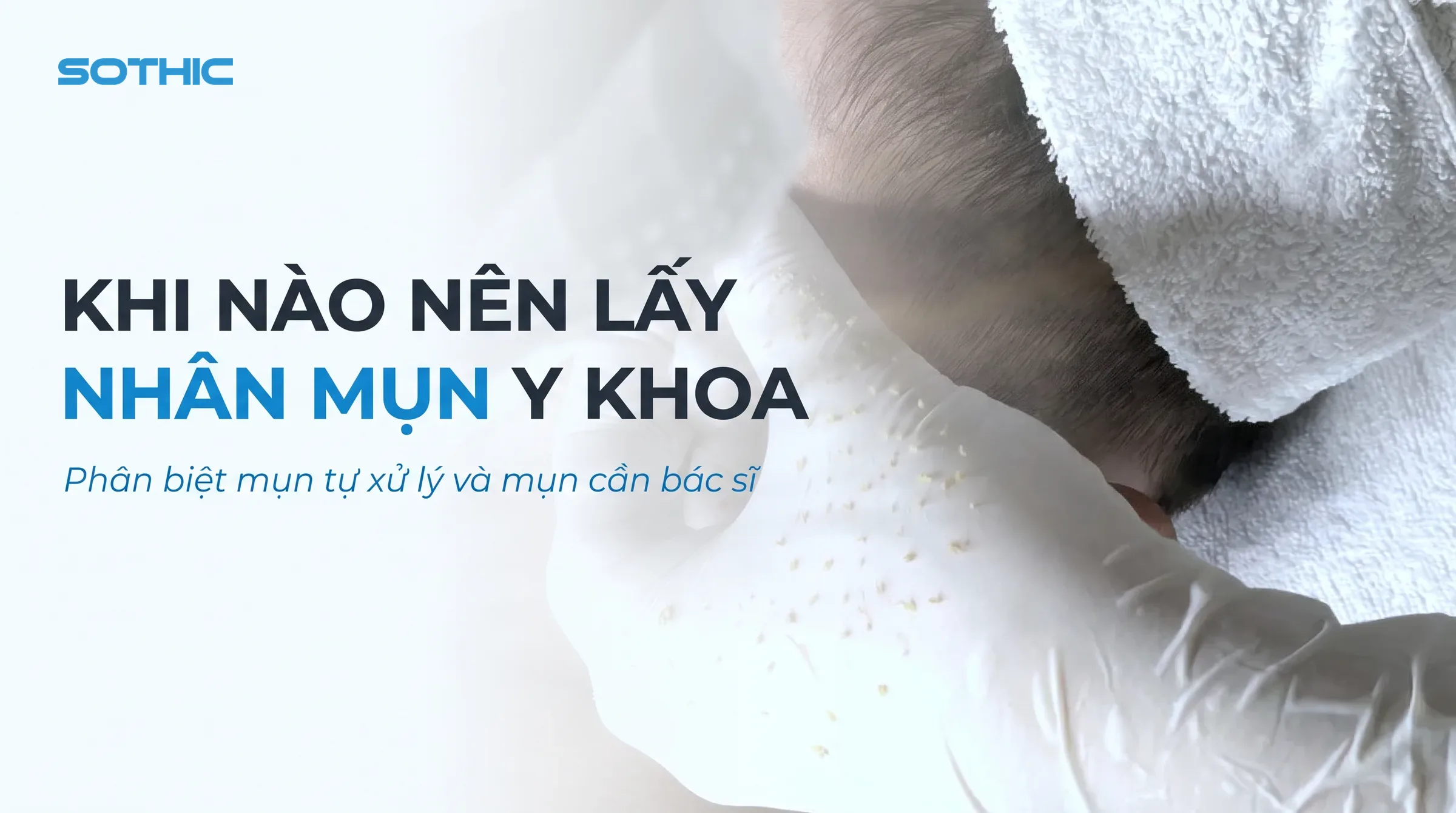 Khi nào nên lấy nhân mụn y khoa