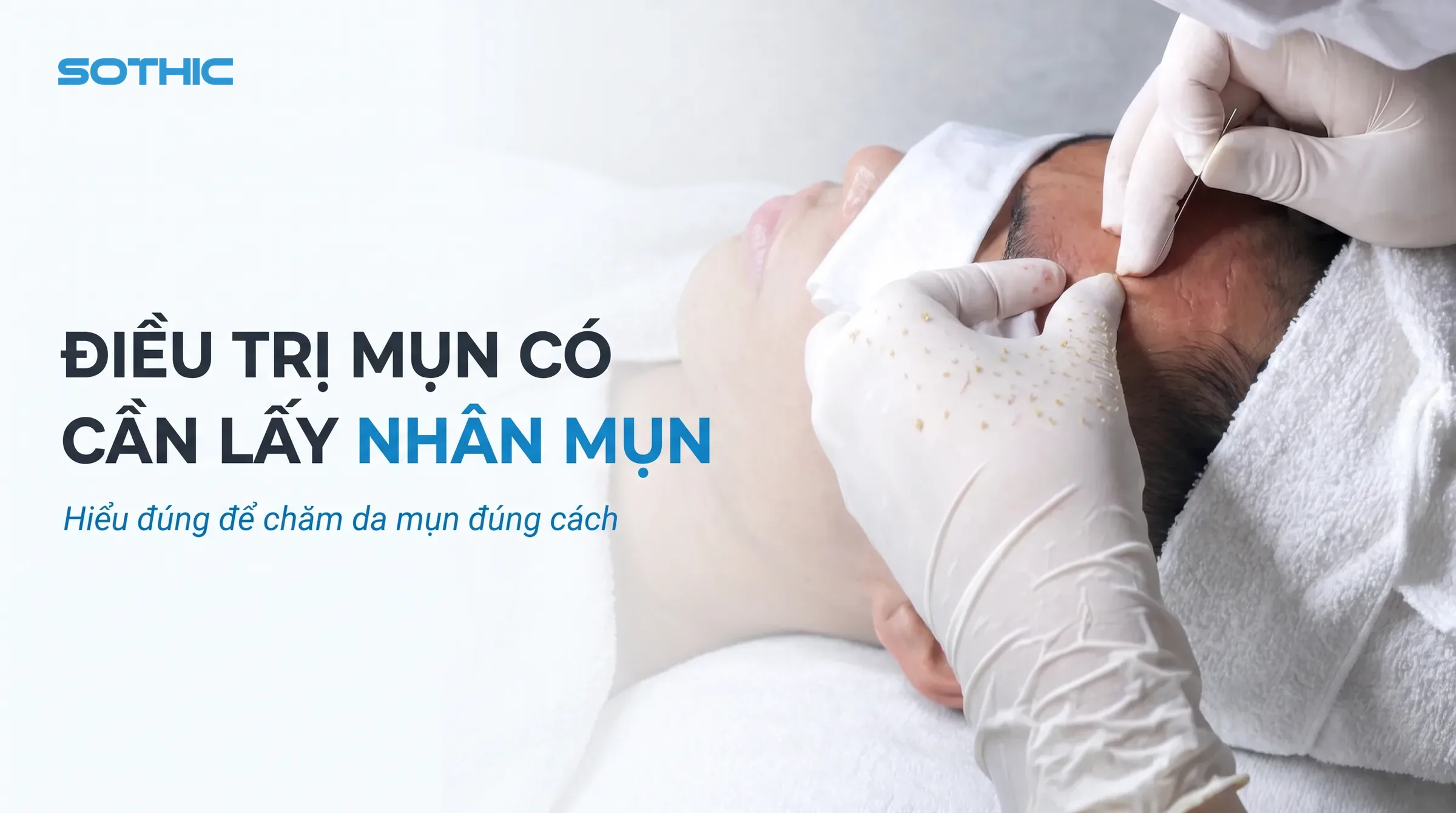 Lấy nhân mụn y khoa