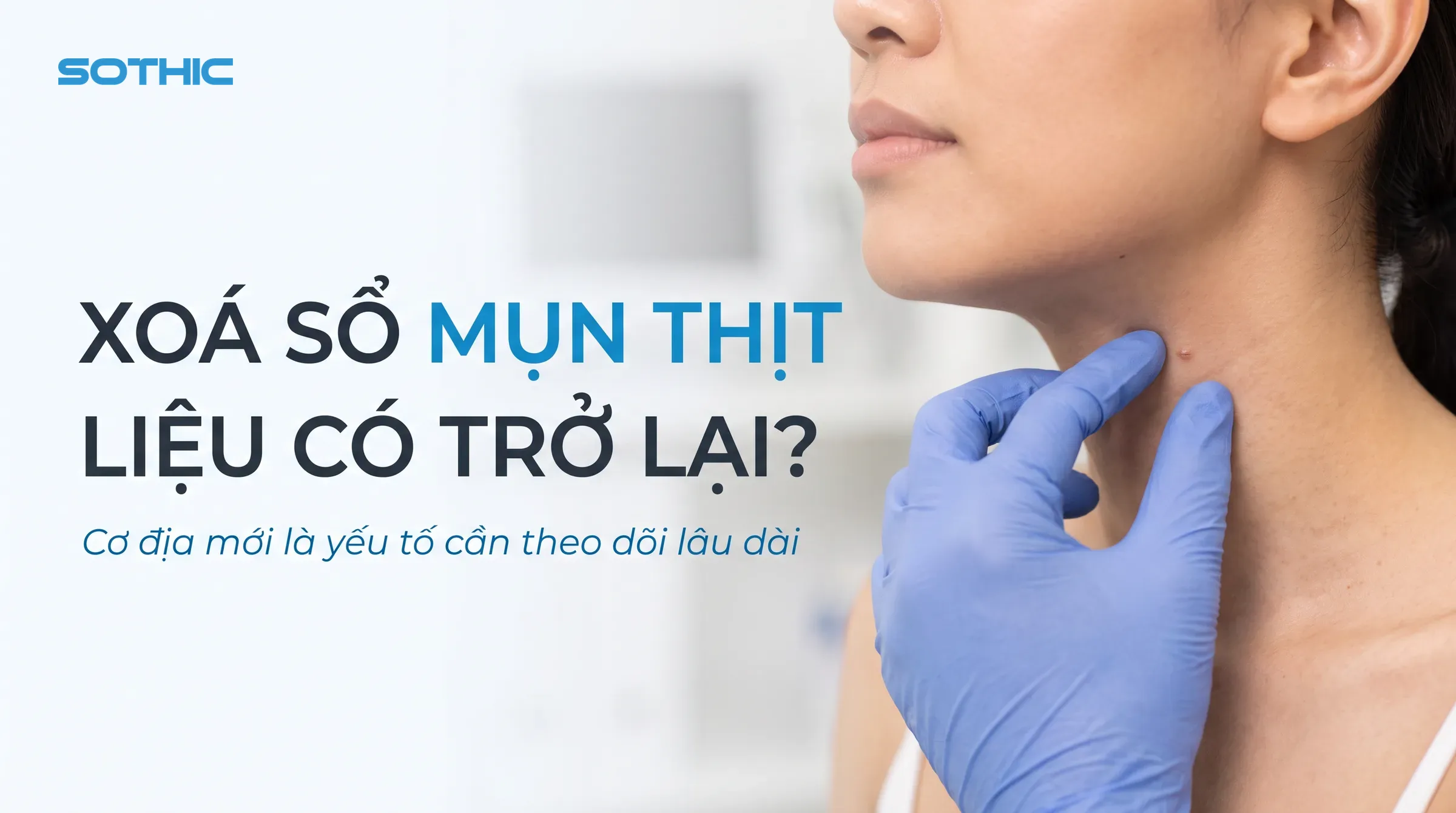 Mụn thịt tái phát