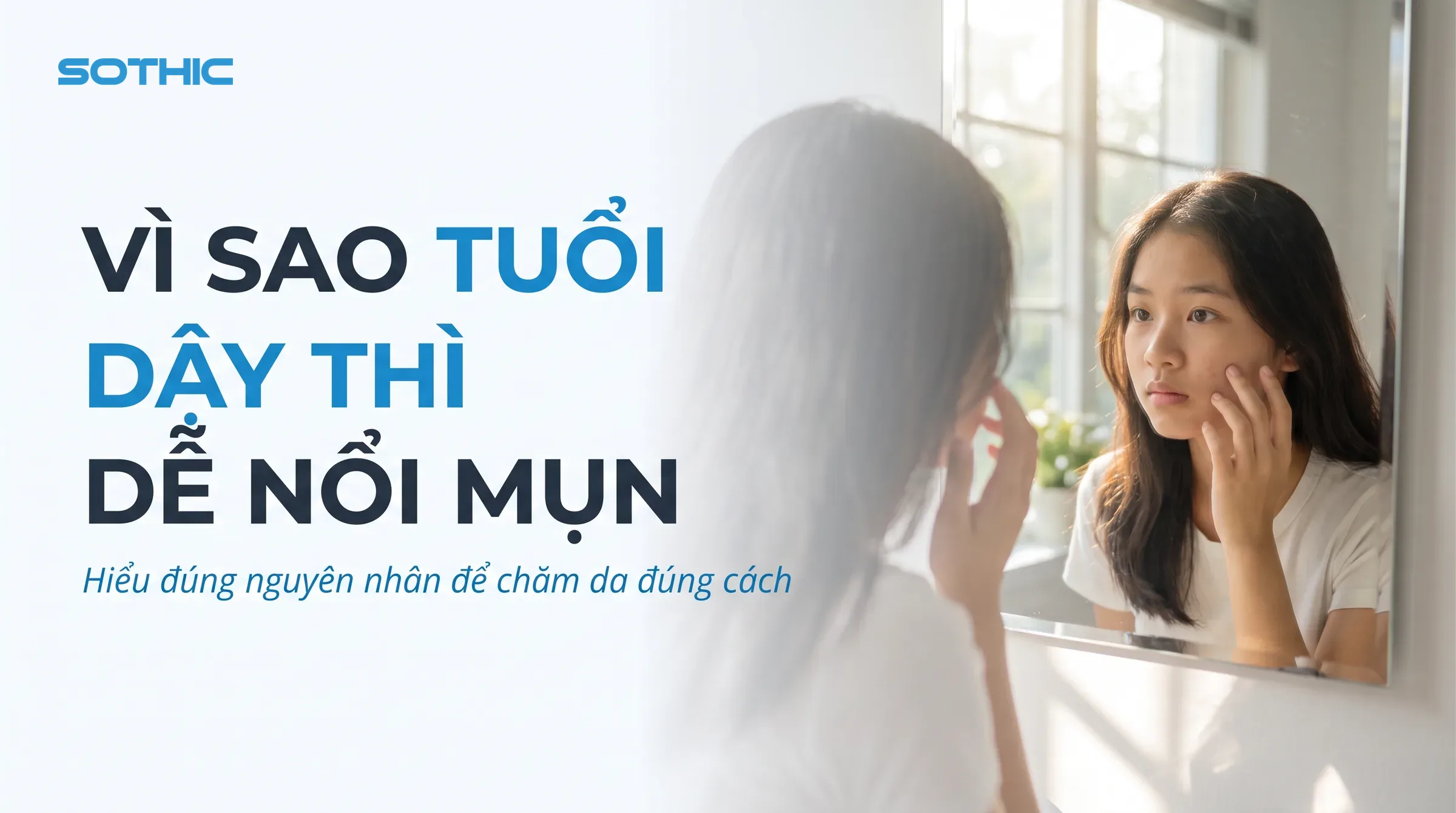 Vì sao tuổi dậy thì dễ nổi mụn