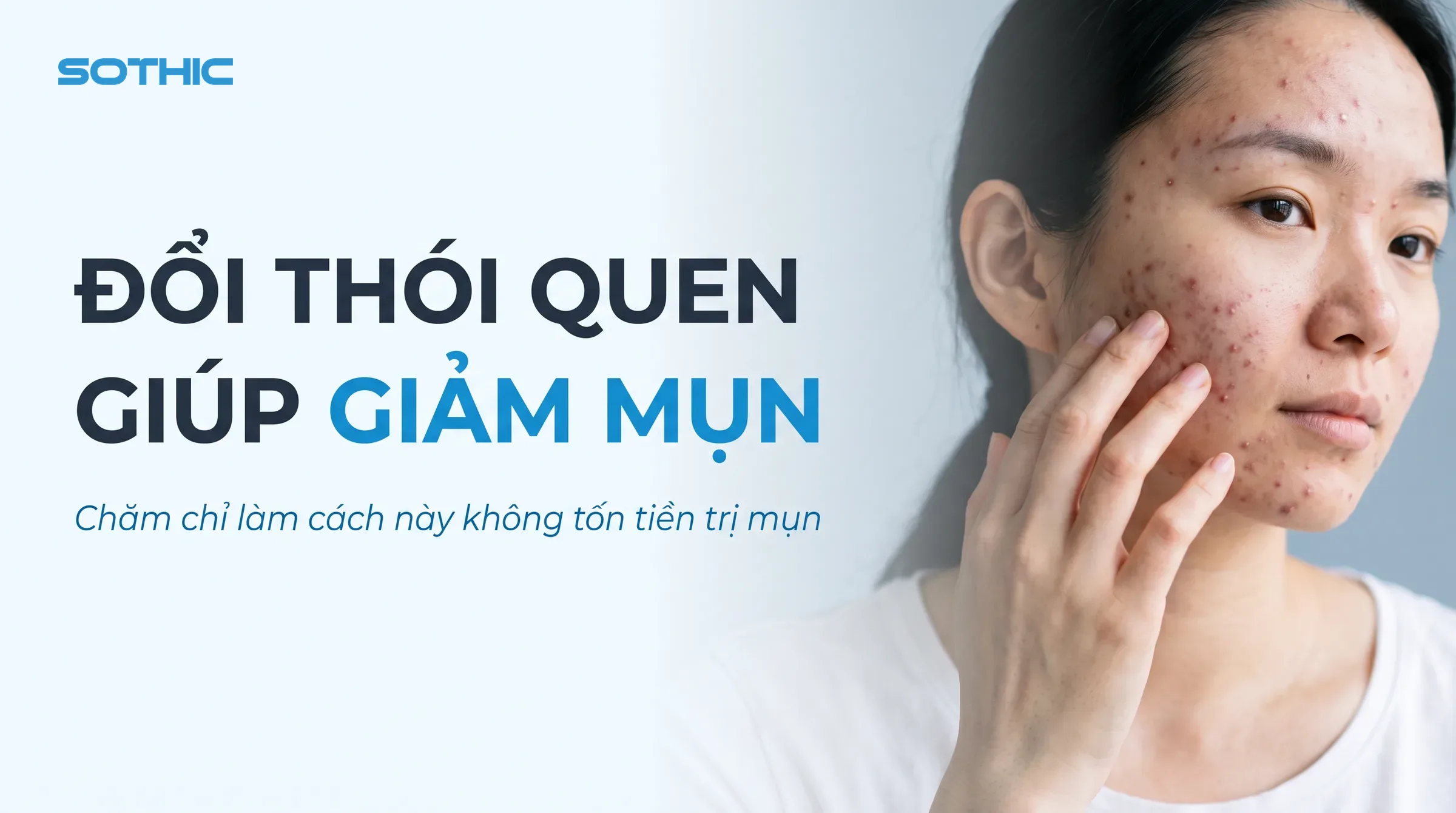 Thói quen gây mụn