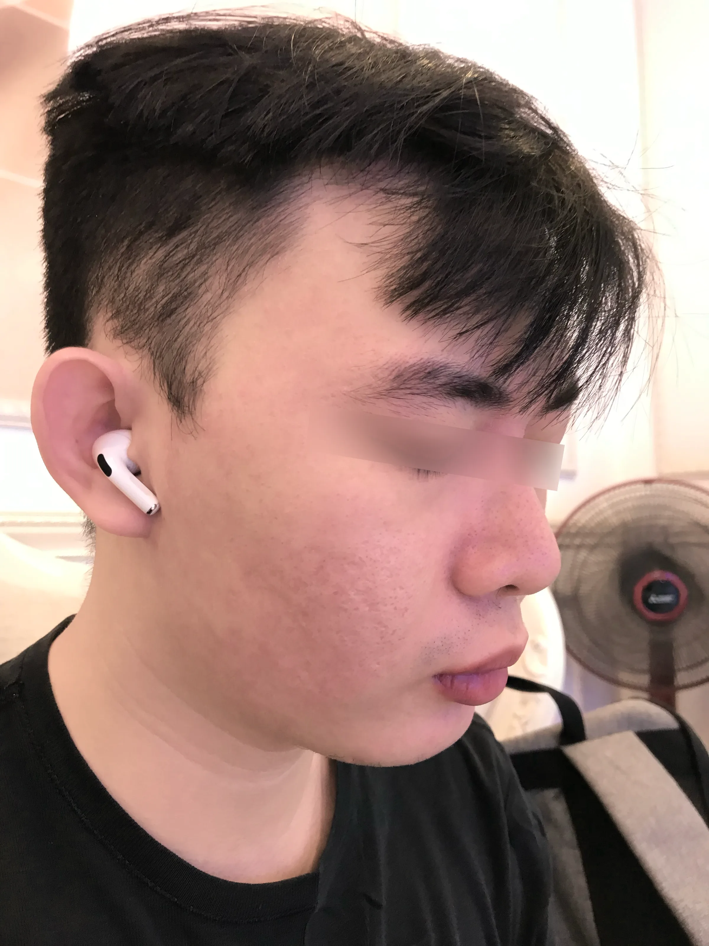 After khách hàng nam thâm mụn