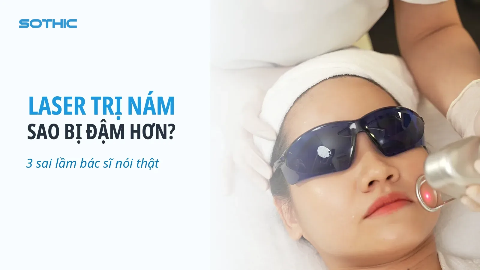 Cover bài viết vì sao trị nám bằng laser bị đậm hơn — khách đang được bắn laser trị nám tại Sothic