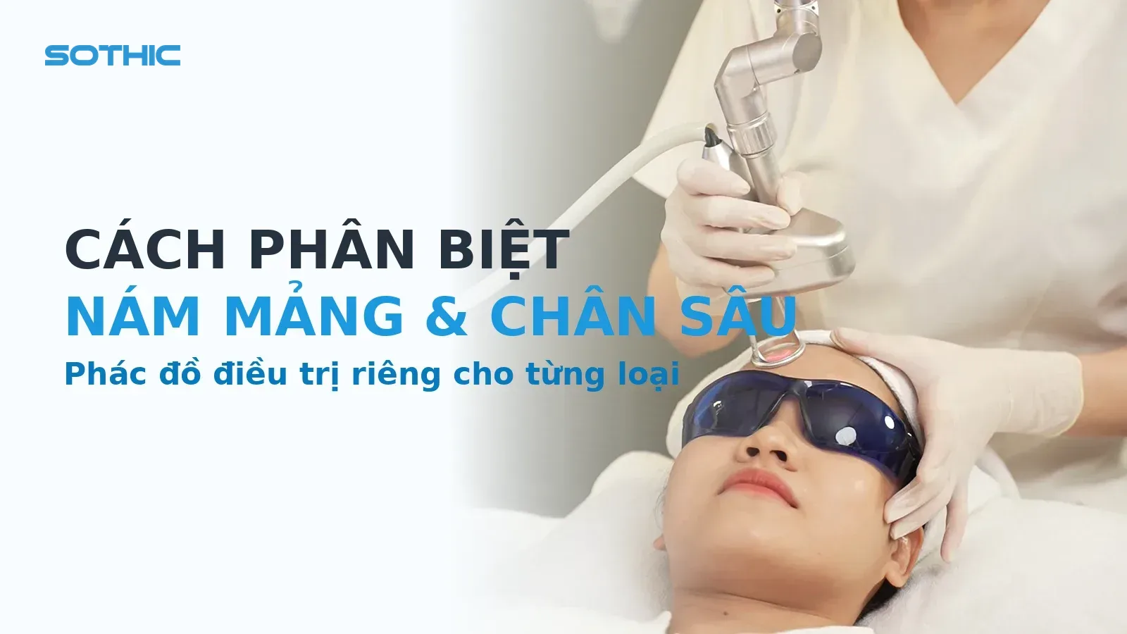 Cover bài phân biệt nám mảng và nám chân sâu: KTV laser trị thâm nám cho khách, chữ Cách phân biệt / nám mảng & chân sâu / phác đồ riêng từng loại