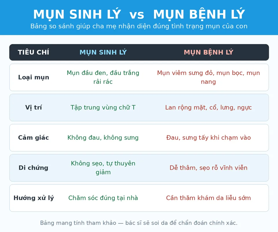 Infographic so sánh mụn sinh lý và mụn bệnh lý ở tuổi dậy thì