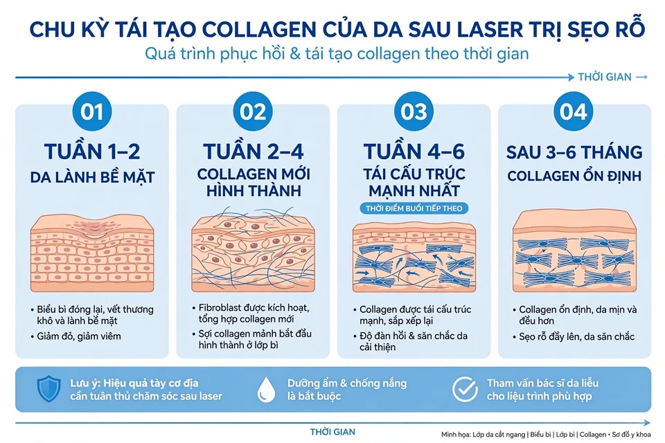 Infographic chu kỳ tái tạo collagen của da sau mỗi buổi trị sẹo rỗ