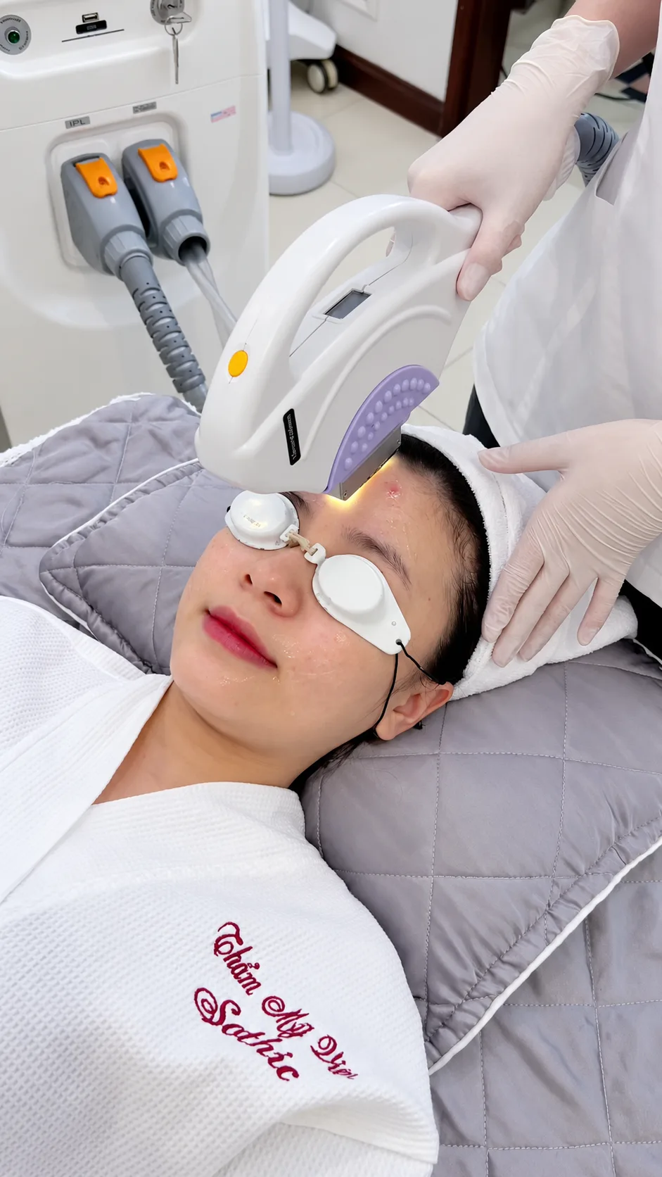 Thao tác điều trị triệt lông bằng công nghệ IPL tại Sothic