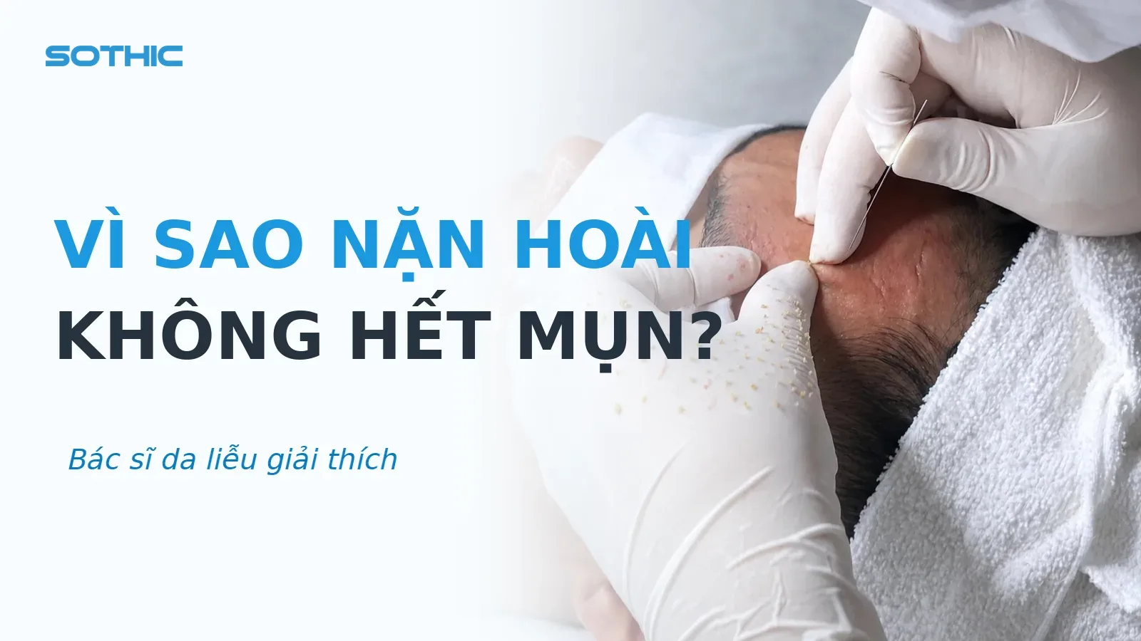Thumbnail bài viết Vì sao nặn hoài không hết mụn? Bác sĩ da liễu giải thích: chữ VÌ SAO NẶN HOÀI KHÔNG HẾT MỤN và kỹ thuật viên đang lấy nhân mụn
