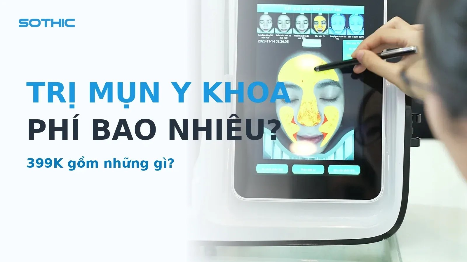 Thumbnail bài Minh bạch phí trị mụn y khoa - máy soi da phân tích da tại Sothic