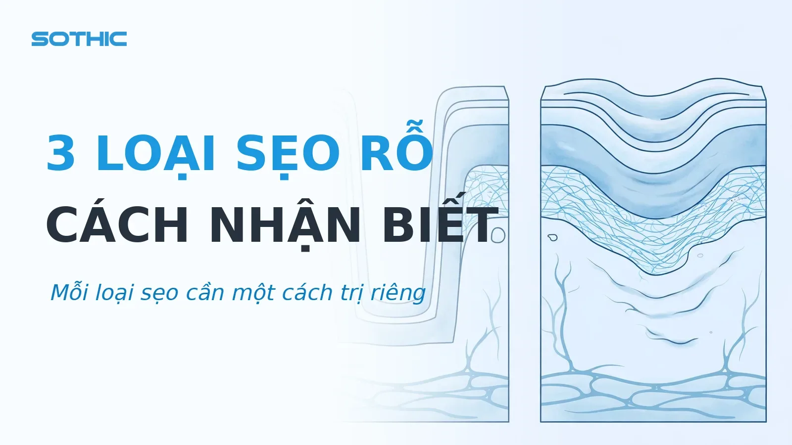 Thumbnail bài viết các loại sẹo rỗ đáy nhọn đáy vuông đáy tròn