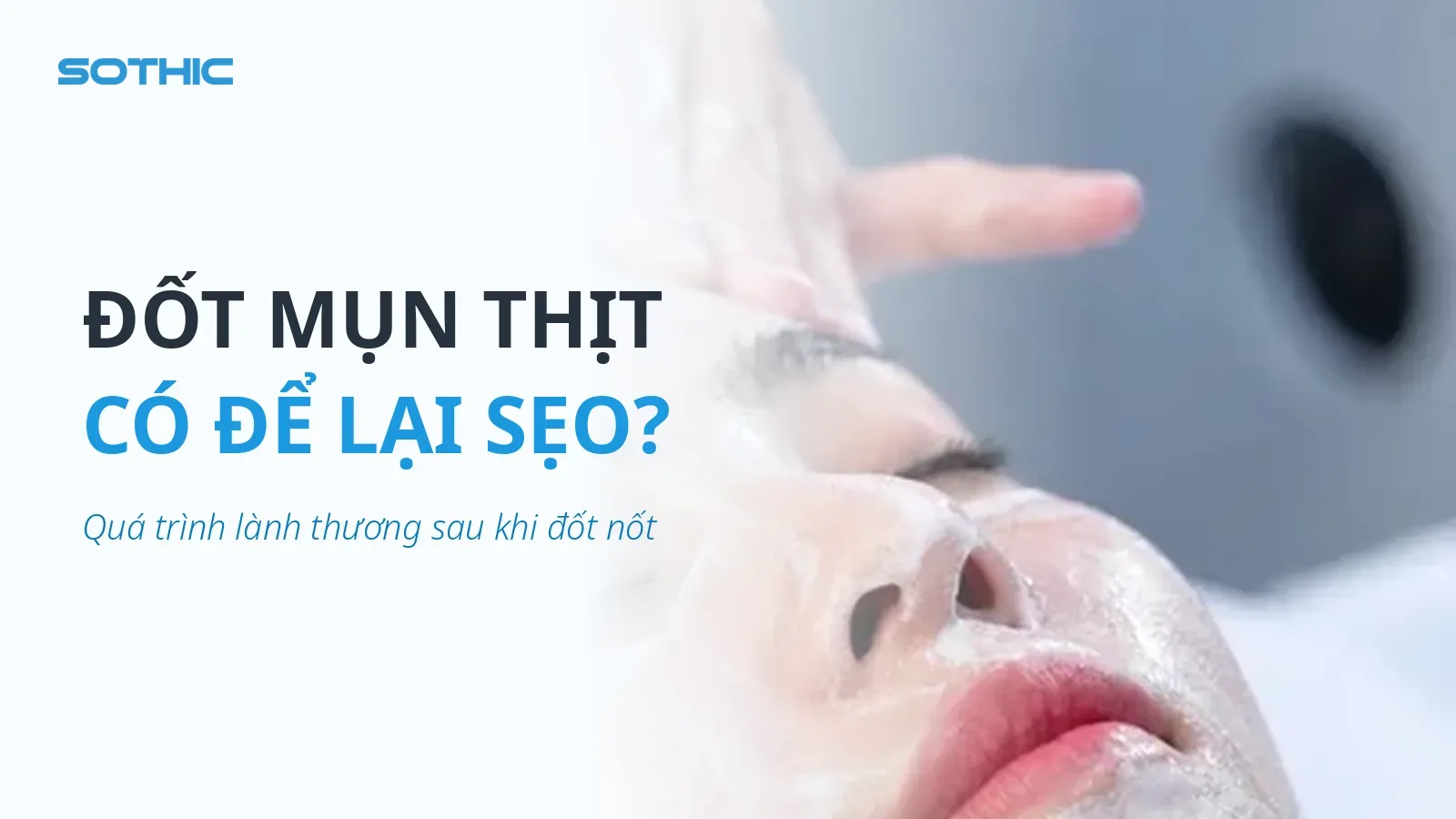 Thumbnail bài viết Đốt mụn thịt có đau không, có để lại sẹo không — chữ ĐỐT MỤN THỊT CÓ ĐỂ LẠI SẸO, ảnh chăm sóc da mặt