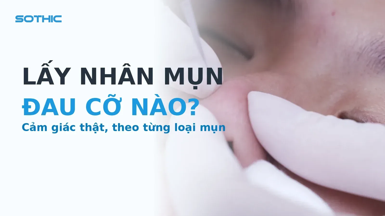 Thumbnail bài Lấy nhân mụn đau cỡ nào: KTV đeo găng vô khuẩn dùng dụng cụ lấy nhân mụn cho khách tại Sothic, chữ LẤY NHÂN MỤN ĐAU CỠ NÀO