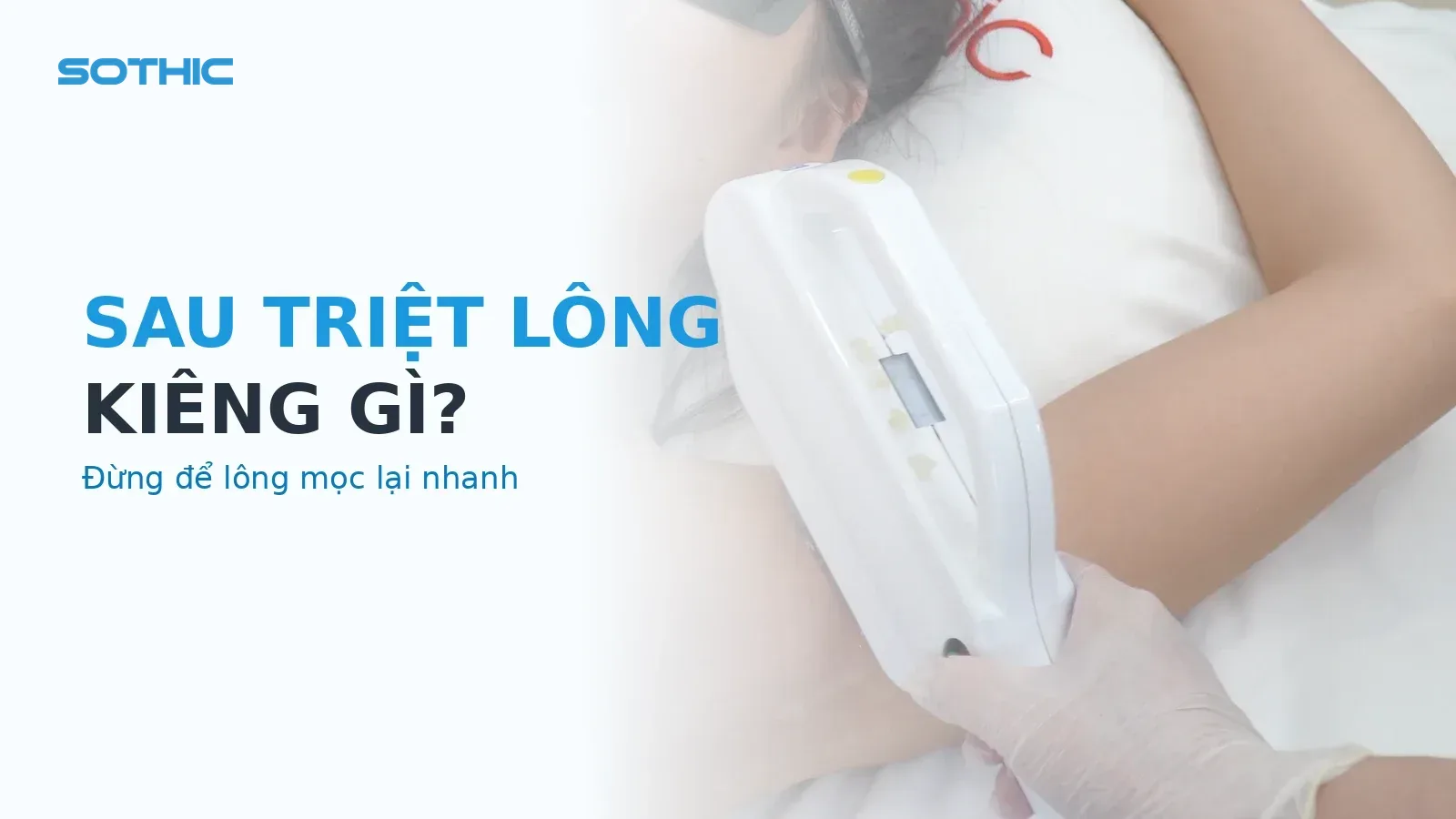 Thumbnail bài sau triệt lông kiêng gì — KTV đang bắn máy triệt lông vùng nách cho khách tại Sothic (bản dựng lại lần 2)