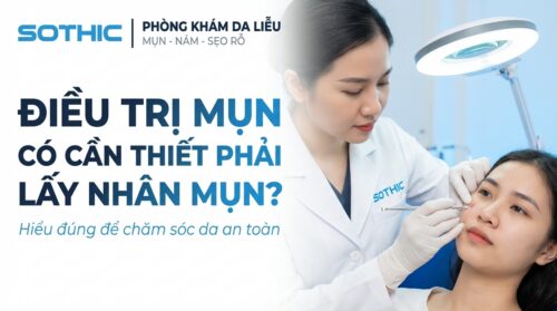 điều trị mụn có cần nặn mụn không
